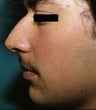 26 year old male patient 