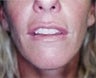40 year old female patient 