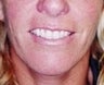 40 year old female patient 