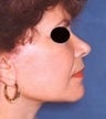49 year old female patient 