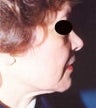 49 year old female patient 