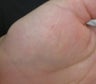 28 year old with tattoo on hand