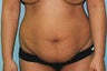 28 year old female patient 