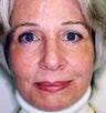 53 year old female patient 
