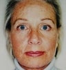 53 year old female patient 