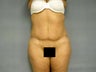 Age: 40, Height: 5"7", Weight: 195lbs.