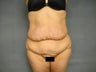 Age: 40, Height: 5"7", Weight: 195lbs.