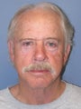 SMAS Facelift/LiteLift/Mini Lift 