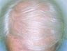 49 year old male patient 