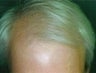 49 year old male patient 