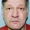 Male patient who underwent nose surgery 