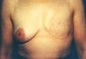 38 year old female patient 
