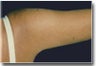 Arm