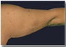 Arm