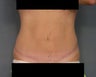 Age: 42, Height: 5"8", Weight: 150lbs.