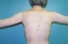 30 year old female patient 