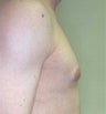 18 year old male patient 