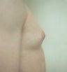 18 year old male patient 