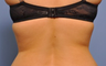 Exilis