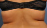 Exilis