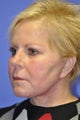 Woman, skin rejuvenation cheeks and neck