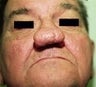 57 year old male patient 