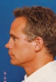 Rhinoplasty