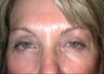 54 year old female patient 