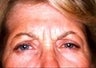 54 year old female patient 