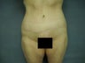 Age: 52, Height: 5"4", Weight: 140lbs.