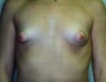 22 year old female patient 