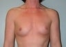 30 year old female patient 