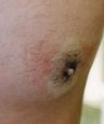 25 year old male patient 