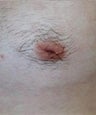25 year old male patient 