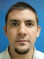 Otoplasty Ear Surgery - Male