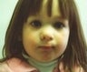 Infant who underwent surgery for a cleft lip and palate 