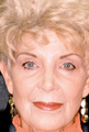 CO2 Laser Skin Resurfacing