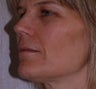 Photofacial 