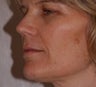 Photofacial 