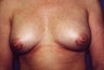 36 year old female patient 