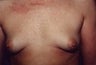 36 year old female patient 