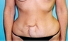41 year old female patient 