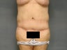 Age: 62, Height: 5"4", Weight: 161lbs.
