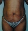 26 year old female patient 