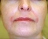 53 year old female patient 