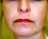 53 year old female patient 
