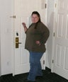 49 year old female with gastric sleeve or sleeve gastrectomy procedure