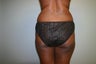 43 year old Female