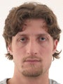 Young male with Rhinoplasty (nose surgery)