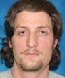 Young male with Rhinoplasty (nose surgery)